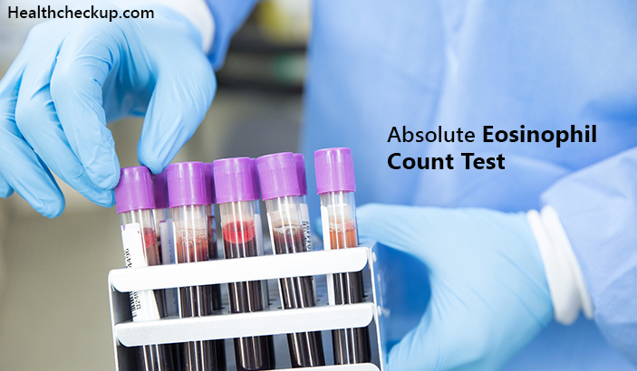 Absolute Eosinophil Count Test