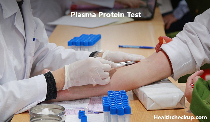 Plasma Protein Test