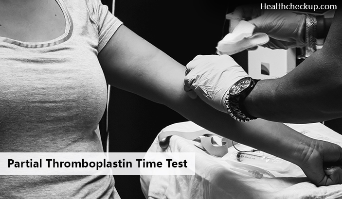 Partial Thromboplastin Time Test