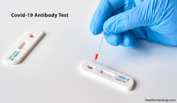 Covid-19 Antibody Test