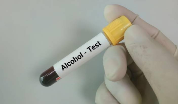 Blood Alcohol Test