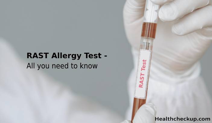 RAST Allergy Test - All you need to know
