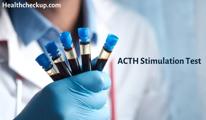 ACTH Stimulation Test - Purpose, Procedure, Results