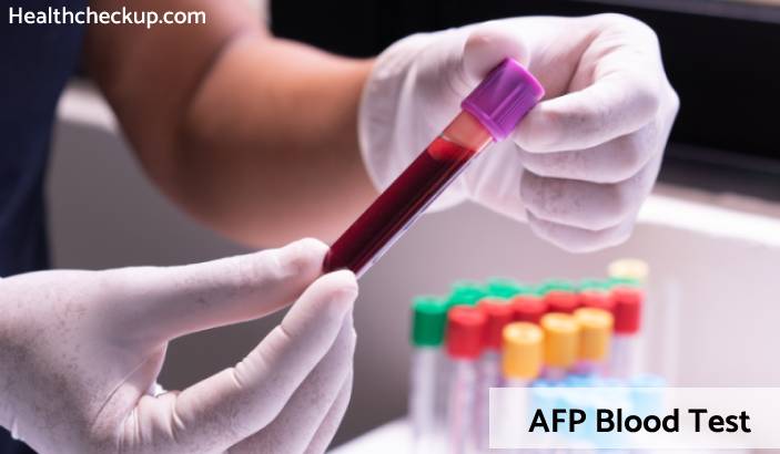 AFP Test - Purpose, Preparation, Results, Normal Range