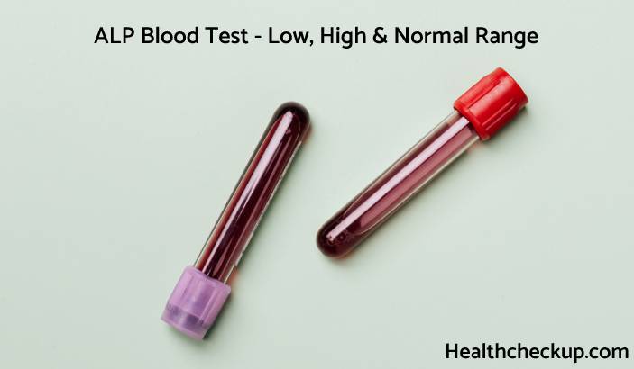 ALP Blood Test: Low, High & Normal Range