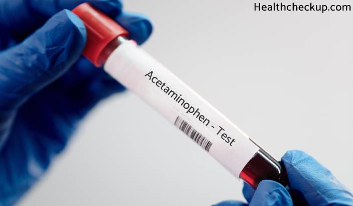 Acetaminophen Level Test - Procedure, Results & Normal Range