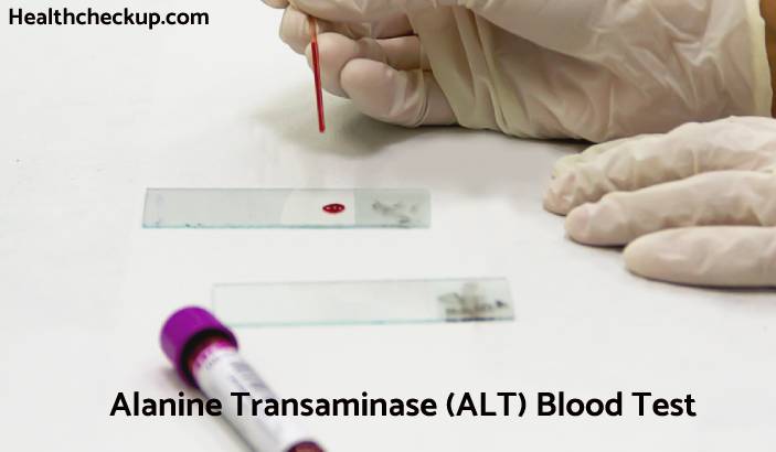 ALT Blood Test - Low, High & Normal Range