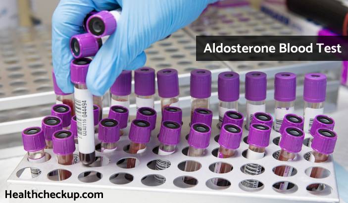 Aldosterone Test - Purpose, Procedure, Results, Normal Range