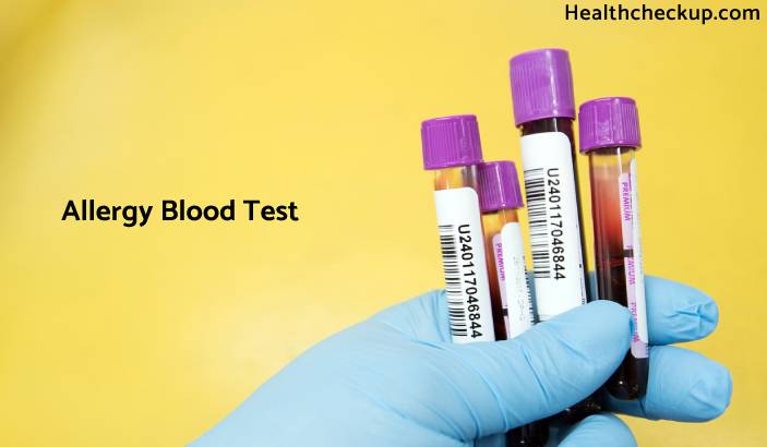 Allergy Blood Test - Purpose, Procedure & Results