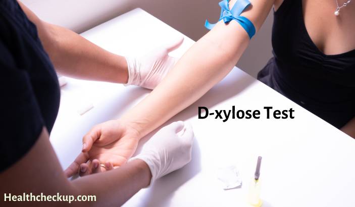 D-xylose Test - Purpose, Procedure, Results, Risks