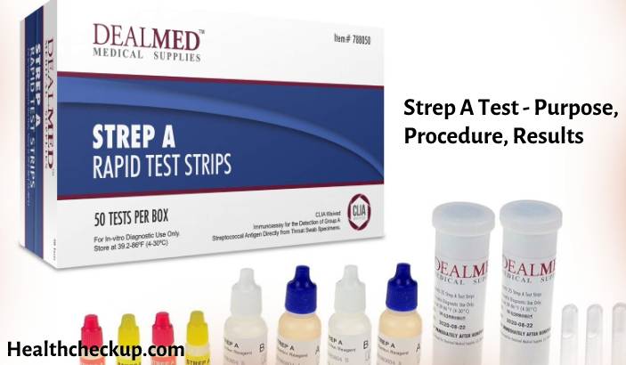 Strep A Test - Purpose, Procedure, Results