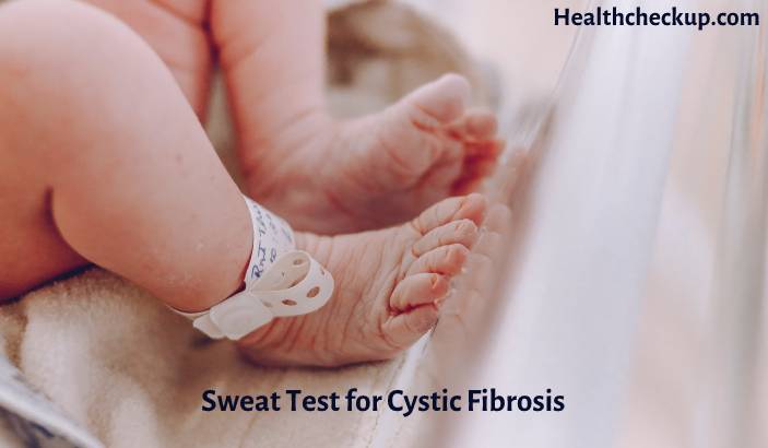 Sweat test for Cystic Fibrosis (CF) - Purpose, Procedure, Results