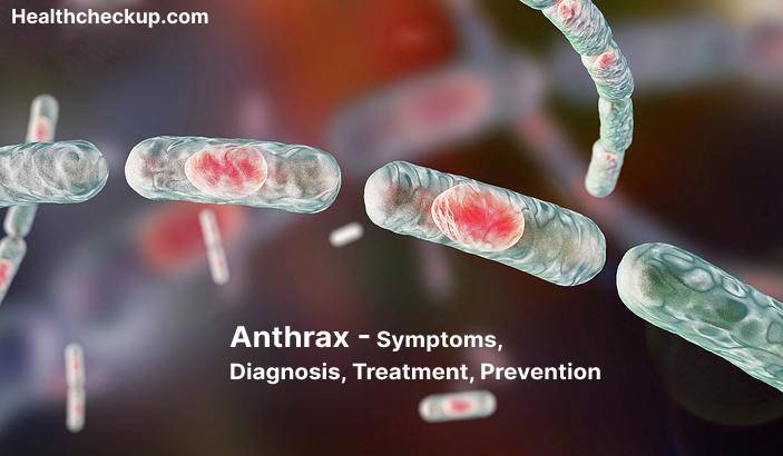 Anthrax -- Symptoms, Diagnosis, Treatment, Prevention