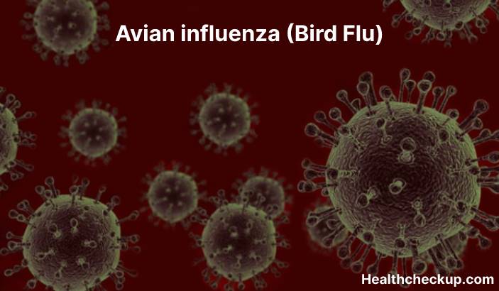 Avian influenza (Bird Flu) - Symptoms, Diagnosis, Treatment, Prevention