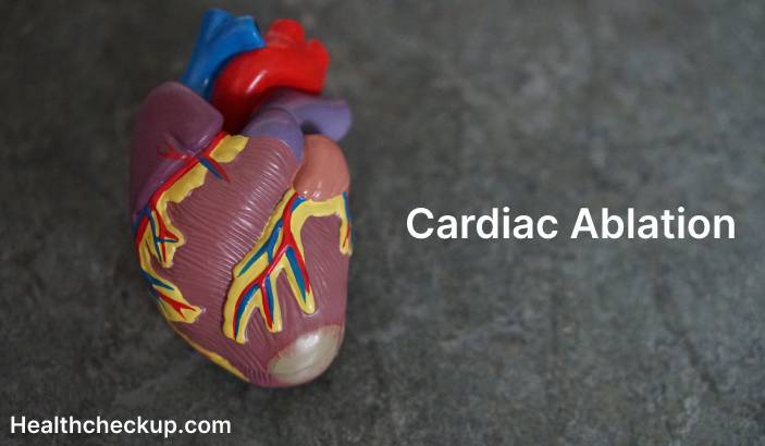 What is Cardiac Ablation? - Techniques, Purpose, Procedure