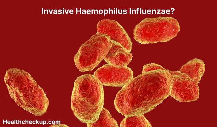 Invasive Haemophilus influenzae - Symptoms, Diagnosis, Treatment, Prevention