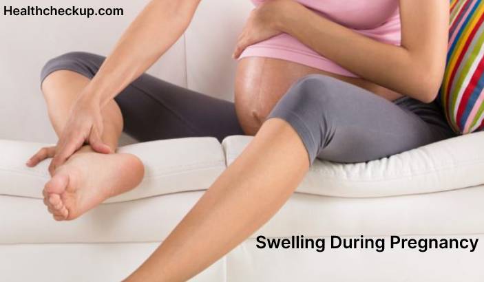 When should swelling during pregnancy be a concern?