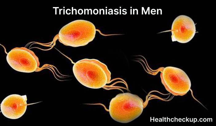 Can a man have trichomoniasis and test negative?