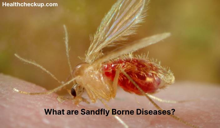 Sandfly borne diseases - Symptoms, Diagnosis, Treatment, Prevention