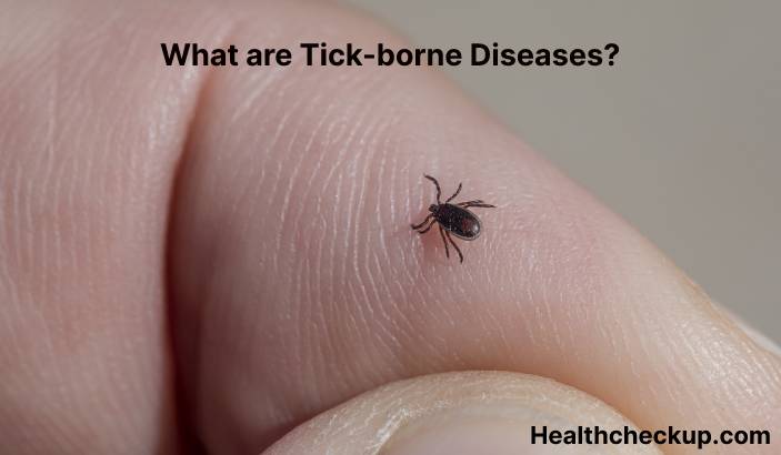 Tick-borne diseases - Symptoms, Diagnosis, Treatment, Prevention