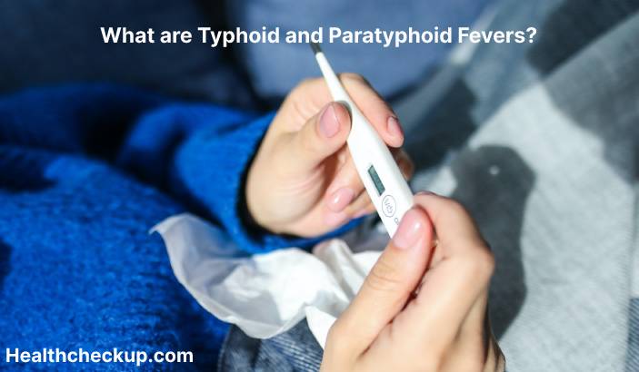 Typhoid and paratyphoid fevers - Symptoms, Diagnosis, Treatment