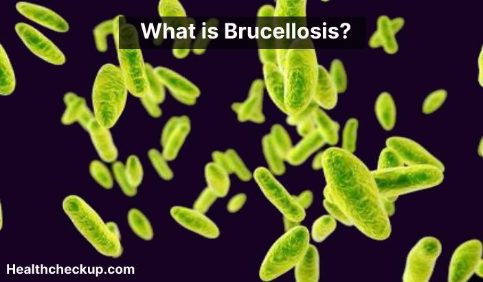 Brucellosis - Symptoms, Diagnosis, Treatment, Prevention