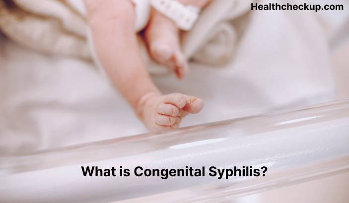 Congenital Syphilis - Symptoms, Diagnosis, Treatment, Prevention