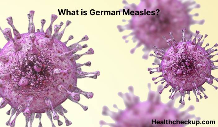What is German measles?