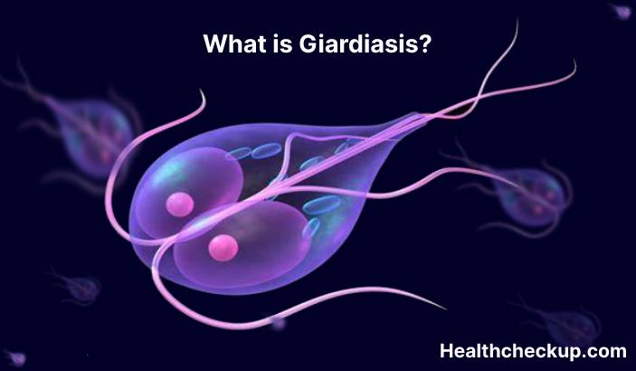 Giardiasis - Symptoms, Diagnosis, Treatment, Prevention