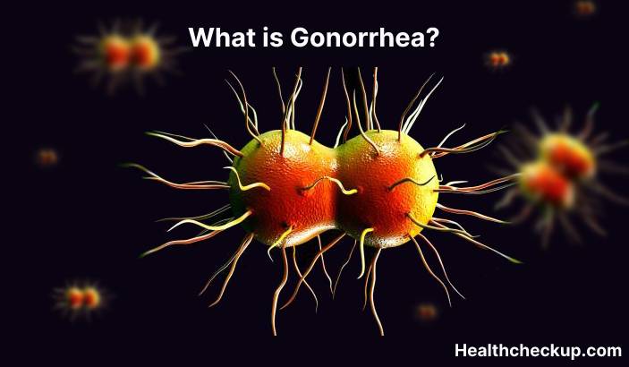Gonorrhea - Symptoms, Diagnosis, Treatment, Prevention