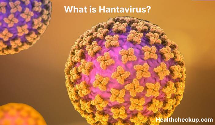 Hantavirus - Symptoms, Diagnosis, Treatment, Prevention