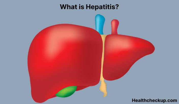 Hepatitis - Types, Causes, Symptoms, Treatment, Prevention