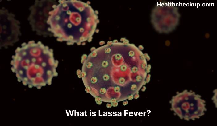 Lassa Fever - Symptoms, Diagnosis, Treatment, Prevention