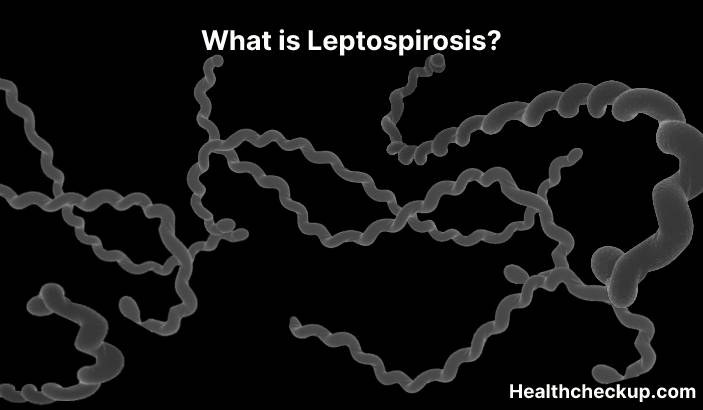 Leptospirosis - Symptoms, Diagnosis, Treatment, Prevention
