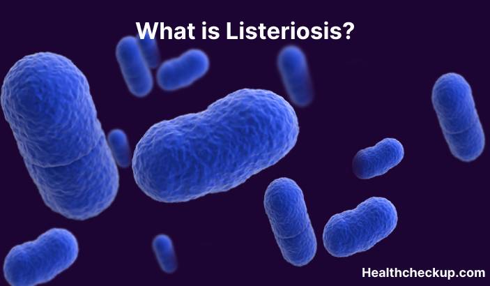 Listeriosis - Symptoms, Diagnosis, Treatment, Prevention