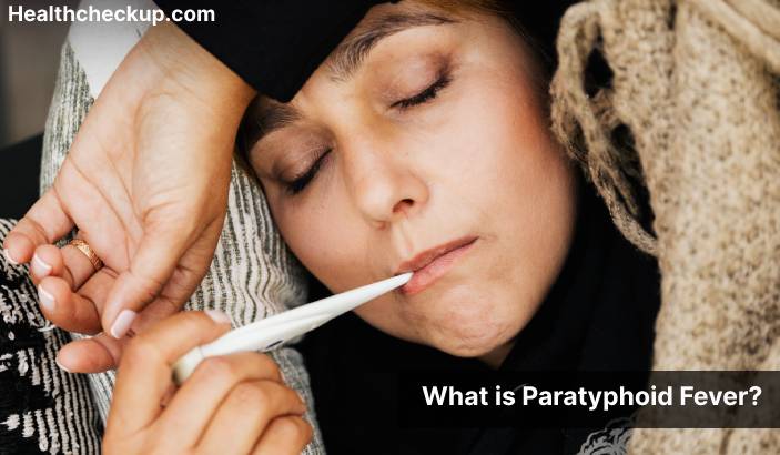 Paratyphoid fever - Symptoms, Diagnosis, Treatment, Prevention