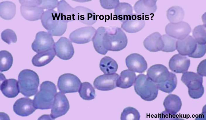 Piroplasmosis - Symptoms, Diagnosis, Treatment, Prevention