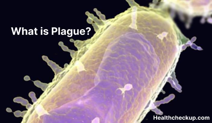 Plague - Types, Symptoms, Diagnosis, Treatment, Prevention