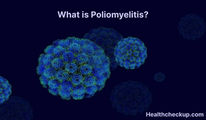 Poliomyelitis - Types, Symptoms, Diagnosis, Treatment, Prevention