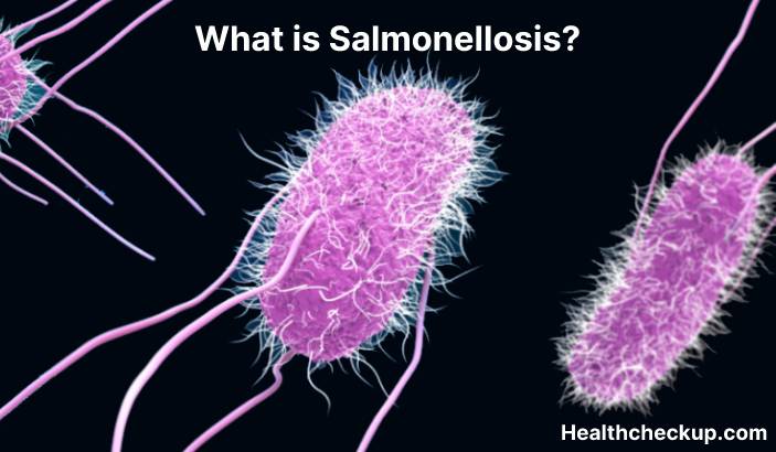 Salmonellosis - Symptoms, Diagnosis, Treatment, Prevention