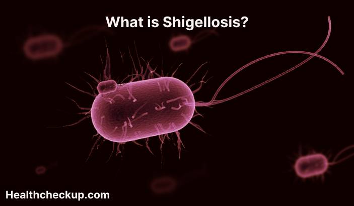 Shigellosis - Symptoms, Diagnosis, Treatment, Prevention