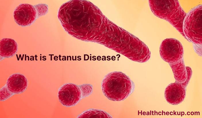 Tetanus - Symptoms, Diagnosis, Treatment, Prevention