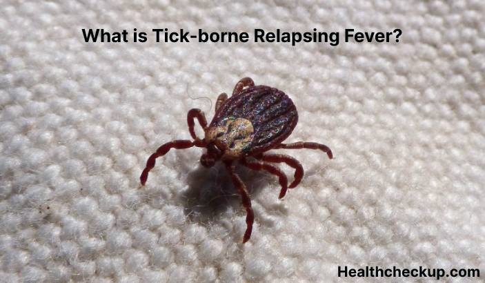 Tick-borne relapsing fever (TBRF) - Symptoms, Diagnosis, Treatment