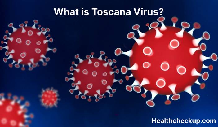 Toscana virus (TOSV) - Symptoms, Diagnosis, Treatment, Prevention