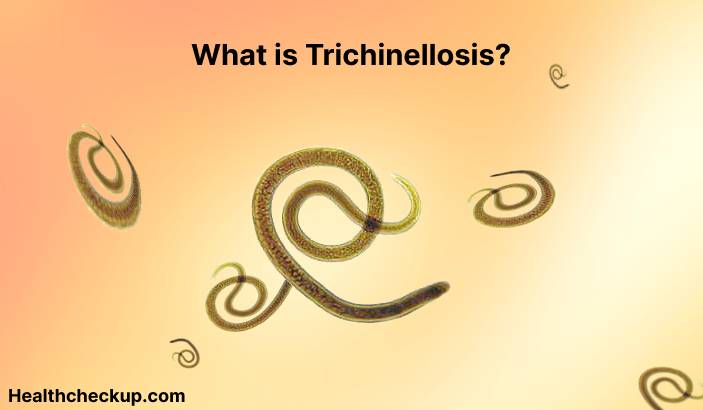 Trichinellosis - Symptoms, Diagnosis, Treatment, Prevention
