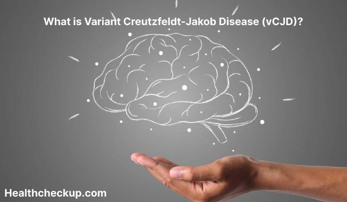 Variant Creutzfeldt-Jakob disease (vCJD) - Symptoms, Diagnosis, Treatment