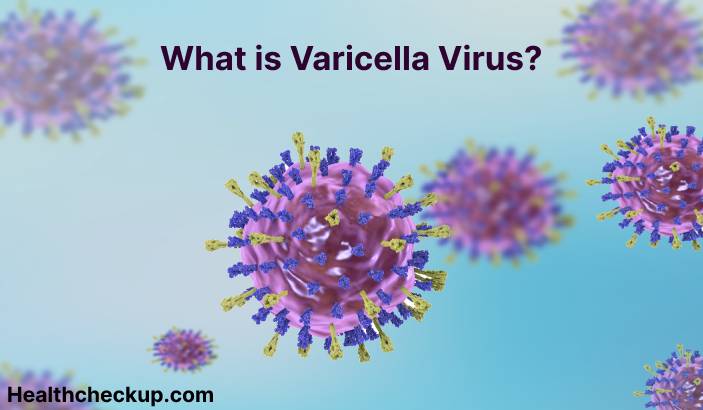 Varicella Zoster Virus - Symptoms, Diagnosis, Treatment, Prevention