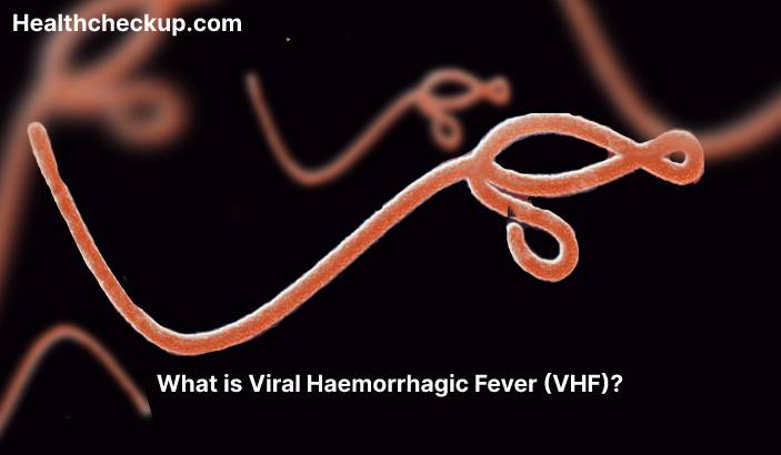 Viral haemorrhagic fever (VHF) - Symptoms, Diagnosis, Treatment