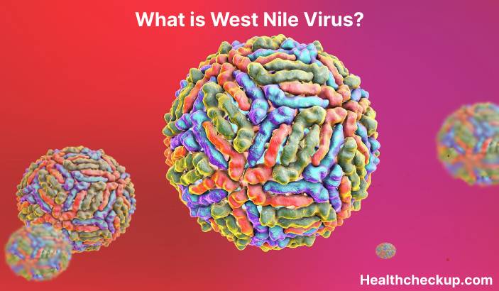West Nile Virus - Symptoms, Diagnosis, Treatment, Prevention