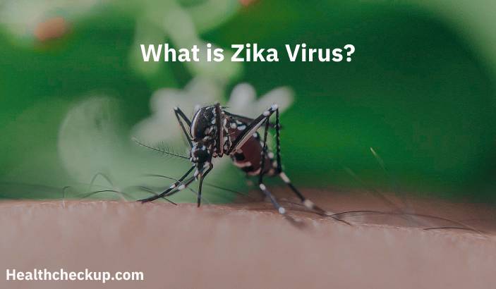 Zika Virus - Symptoms, Diagnosis, Treatment, Prevention